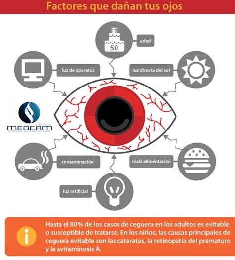 Clínica Medcam Factores Que Dañan Tus Ojos