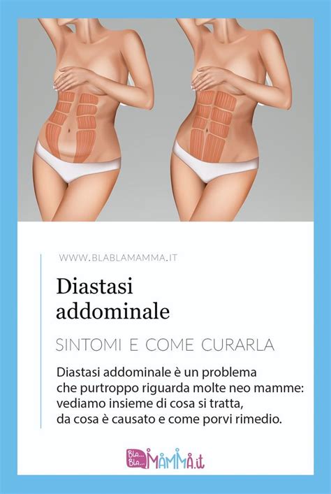 La diastasi addominale è un problema che molte donne accusano nel