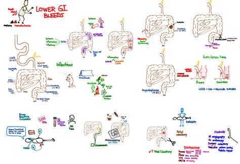 Upper Gi Bleed Rush Emergency Medicine