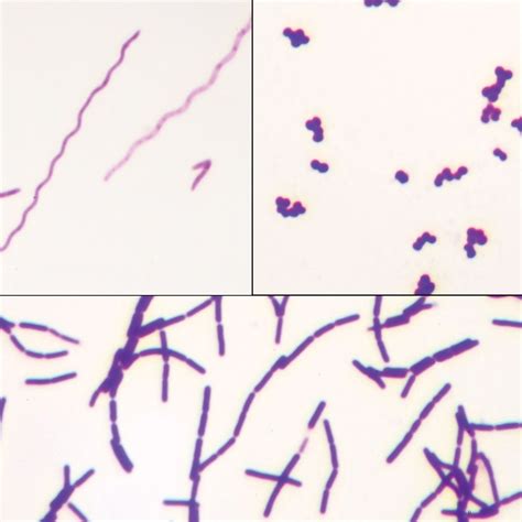 Bacteria Types Slide, Separate Smears, Gram Stain | Carolina.com