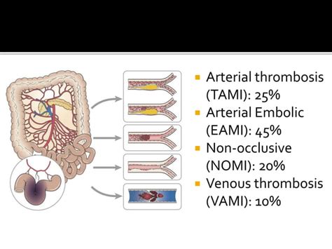 Guideline Acute Mesenteric Ischemia Ppt