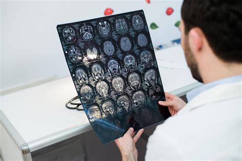 Daño Cerebral Traumático Lesión Encefálica Traumática Medlineplus