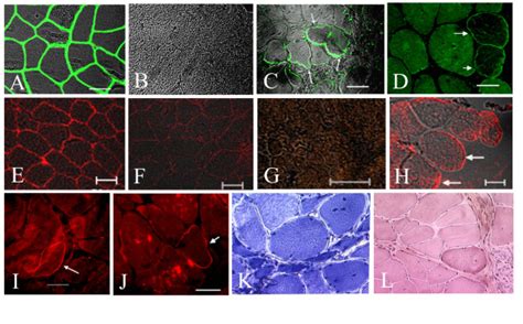 Immunofluorescence Analysis Using The Specific Human Anti Dystrophin