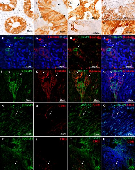 AE Immunolocalization Of IQGAP1 Protein On Paraffin Embedded Tissue