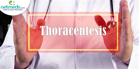 Thoracentesis Purpose Benefits Results And Risks Of This Pleural