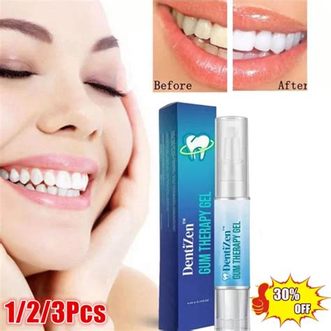 X Pen Extra Strong White Tooth Whitener Stain Remover Uk