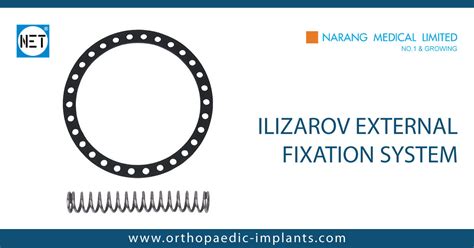 Ilizarov External Fixation System Ilizarov External Fixation System