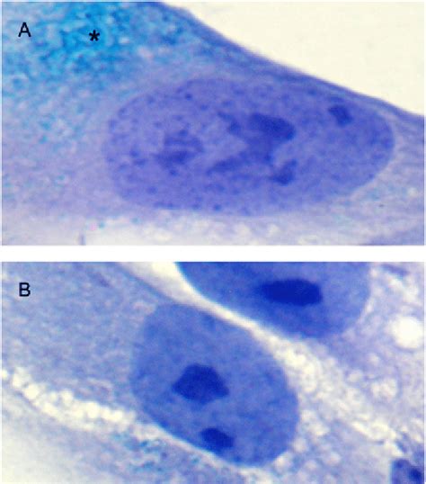 Sa Gal Staining In Dtscs A Microphotograph Of Sa Gal Cell With