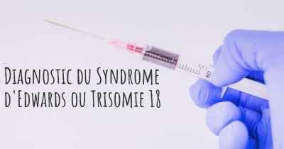 Quelle Est L Esp Rance De Vie Avec Le Syndrome D Edwards Ou Trisomie