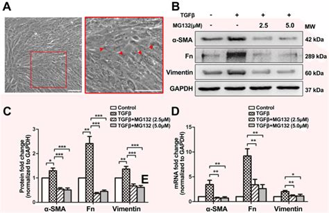 Proteotoxic Stress Induces Apoptosis And Inhibits Tgf Induced Emt In