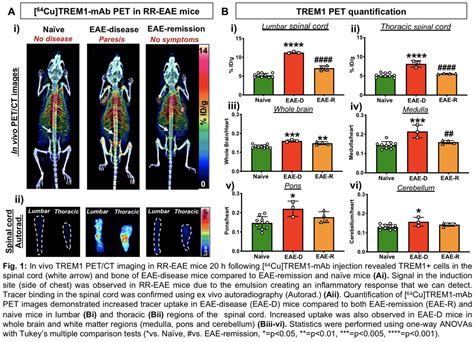 Trem1 Pet Imaging Of Pro Inflammatory Myeloid Cells Distinguishes