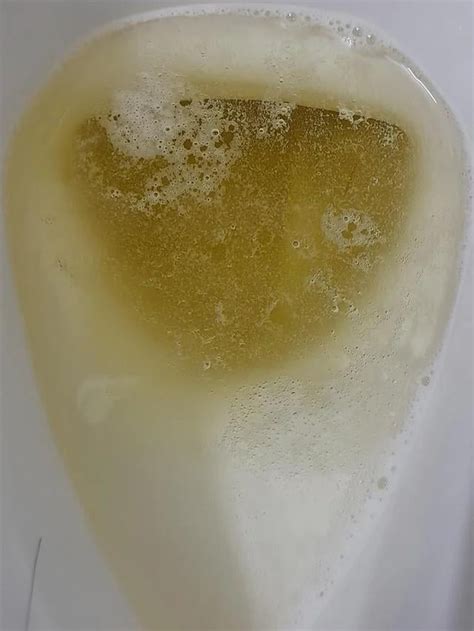foam  urine bubbles  harry oloughlin blog