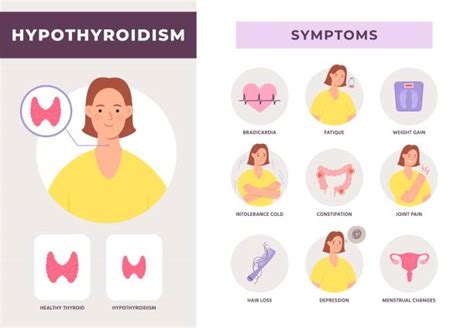 840 Hypothyroidism Stock Illustrations Royalty Free Vector Graphics