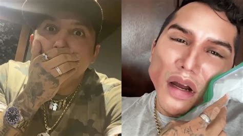 Edwin Luna Aparece En Redes Sociales Con Una Mala Cirug A