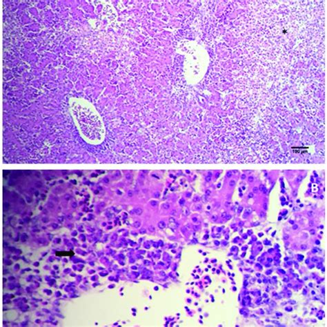 Pathophysiology Of Hemophagocytic Lymphohistiocytosis Hlh With Download Scientific Diagram