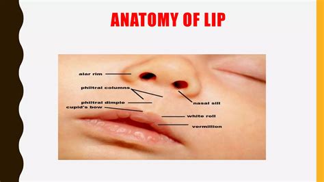 Cleft Lip And Cleft Palate Ppt Ppt Free Download