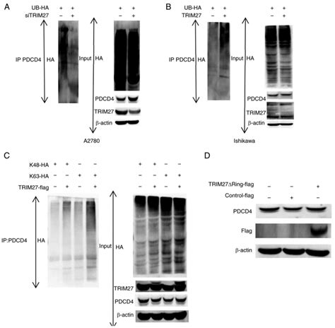 TRIM27 Regulates The Expression Of PDCD4 By The Ubiquitinproteasome