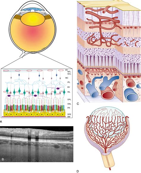 Pathophysiology Of Retinopathy Of Prematurity Clinical Tree