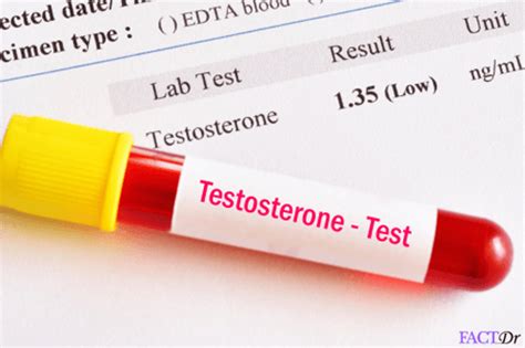 Free Testosterone Procedure Range And Purpose Factdr