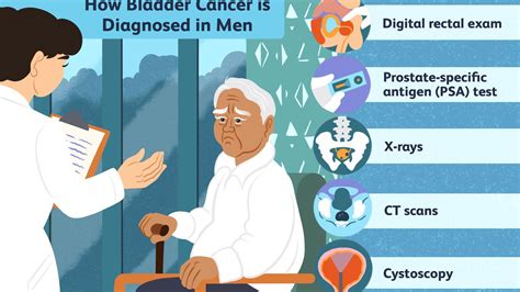detect bladder cancer desksandwich