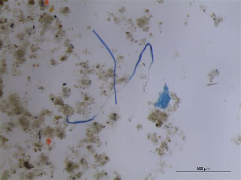 First Discovery Of Microplastics From Water T Eurekalert