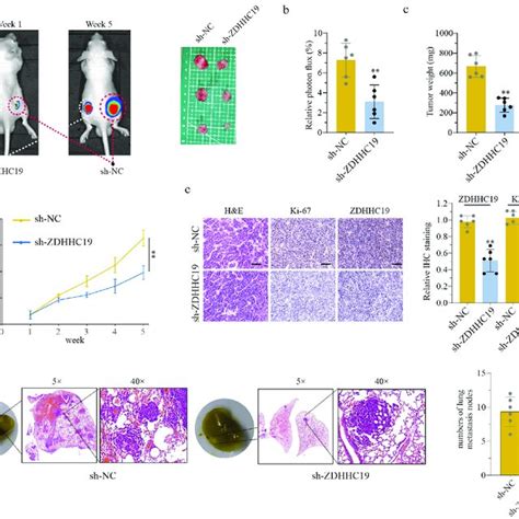 ZDHHC19 Knockdown Suppress Tumor Growth In Vivo A The Tumor