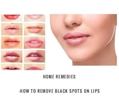 How To Remove Black Spots Around Lips Naturally | Lipstutorial.org