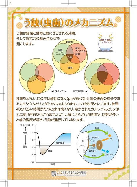 虫歯のメカニズム