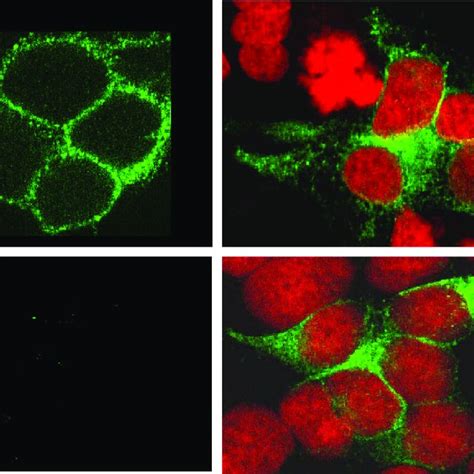 Schematic Representation Of The Rat Neuromedin U Receptor 1 Nmur1