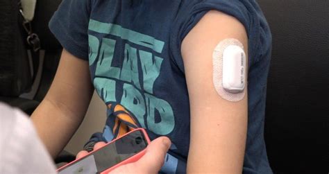 Более 200 детей в ЛНР уже бесплатно получили медицинские датчики и ...