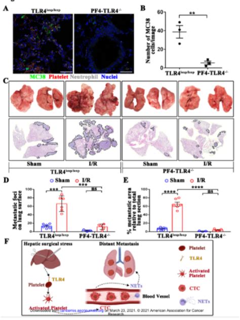 Cancer Research血小板tlr4 Erk5轴促进手术应激后net介导的循环肿瘤细胞捕获和远处转移细胞肿瘤血小板转移小鼠