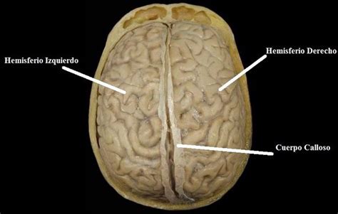 Hemisferios Cerebrales