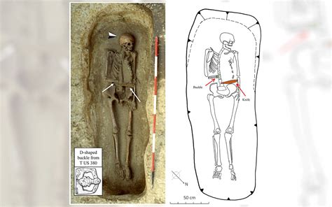 Knife-Armed Man Leaves World's Coolest Skeleton | Live Science