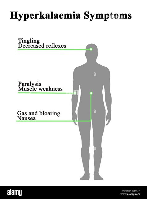Six Symptoms of Hyperkalaemia Stock Photo - Alamy