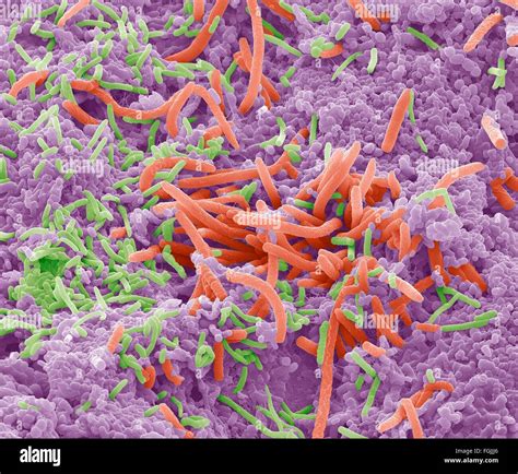 Tongue bacteria hi-res stock photography and images - Alamy