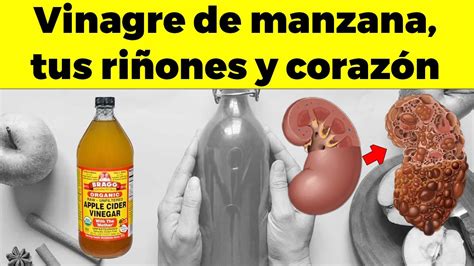 Lo Que El Vinagre De Manzana Le Puede Hacer A Tus Ri Ones Esmalte