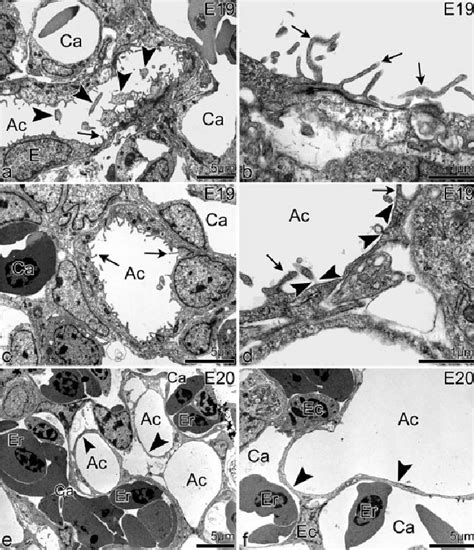 Transmission Electron Photomicrographs Showing The Terminal Mechanisms