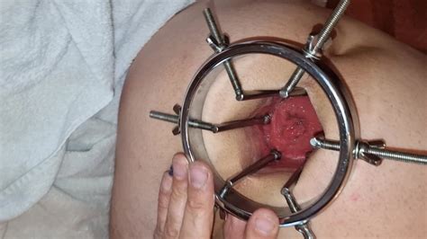 Deep View Into My Asshole My Ass Spreader Nude Pics Xhamster