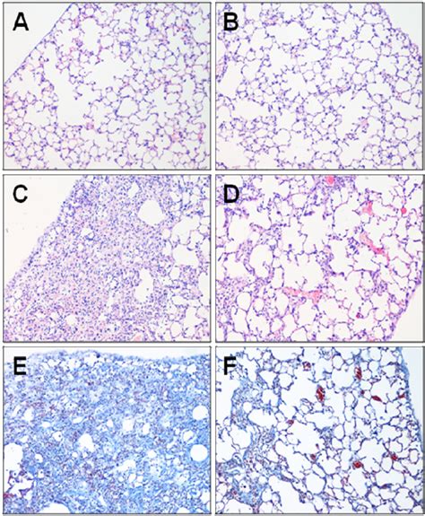 Representative Histological Lung Sections From Each Group Removed Download Scientific Diagram