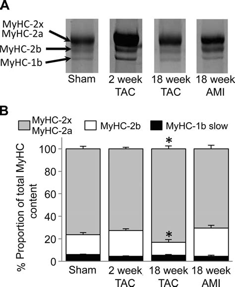 Myosin Heavy Chain Myhc Content Of Diaphragm Muscle From The Sham Download Scientific Diagram