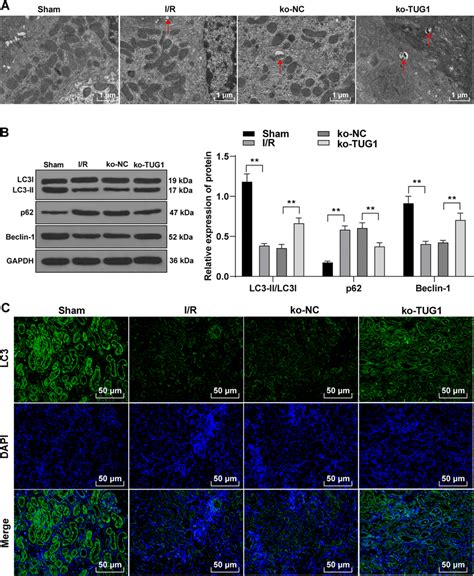 Tug Knockdown Promotes Autophagy In Rats With Acute Renal Injury