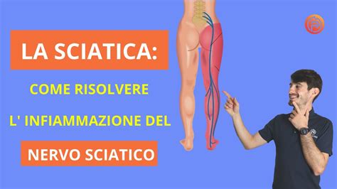 La Sciatica Infiammazione Del Nervo Sciatico Come Trattarla 2022 Youtube