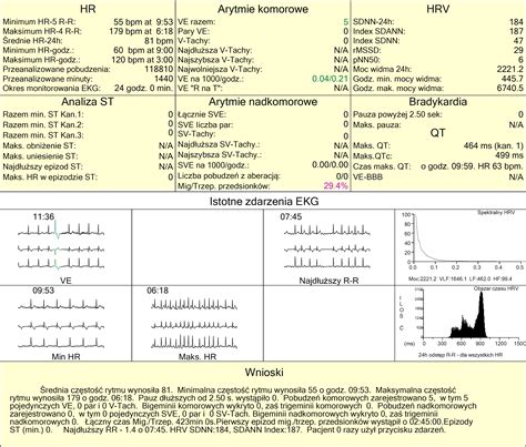 Holter Ekg Interpretacja Wyniku W Obrazach Klinicznych Olszanecka
