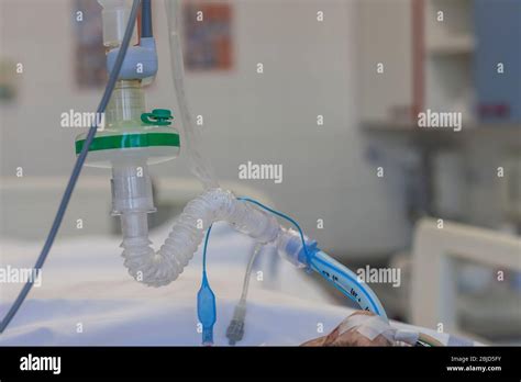 Endotracheal Intubation High Resolution Stock Photography And Images