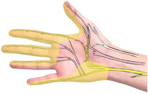 The Fourth Digital Nerve Is Transferred End To End To The First Digital