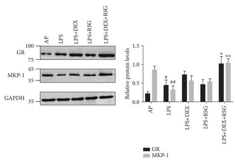 DUSP1 MKP1 Antibody Affinity Biosciences