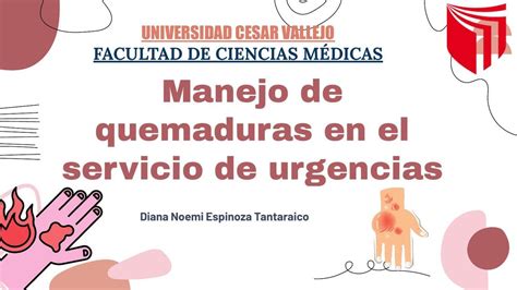 Manejo De Quemaduras En El Servicio De Urgencias Diana Espinoza UDocz