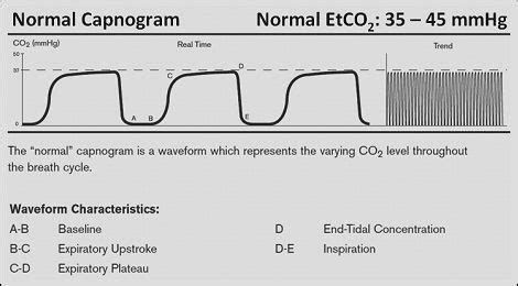 normal end tidal co2 range - Name Tag Chatroom Pictures Library