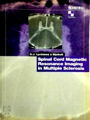 Spinal Cord Magnetic Resonance Imaging In Multiple Sclerosis Special