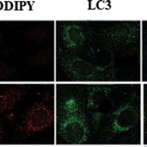 Effect Of TCDD On The Co Localization Of LC3 With LDs Co Localization